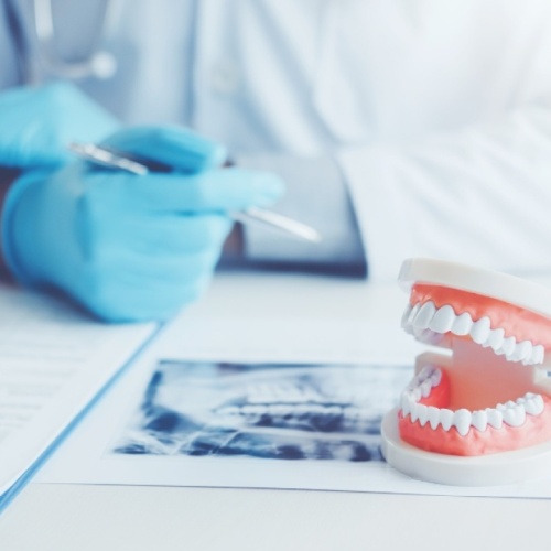 Szkolenia dla dentystów z leczenia kanałowego zębów